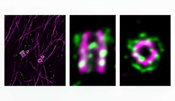 Study sheds light on proteins linked to congenital developmental disorders